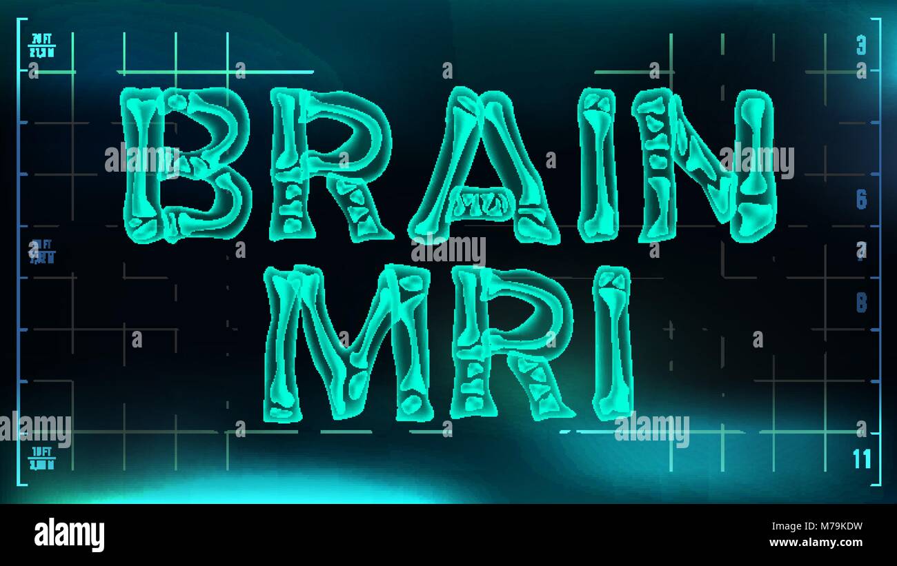 Brain Mri Banner Vector Medical Background Transparent Roentgen