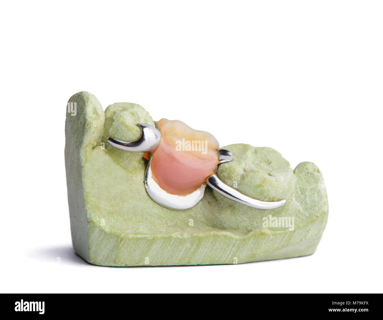 Denture on plaster model. Isolated on white background Stock Photo Alamy