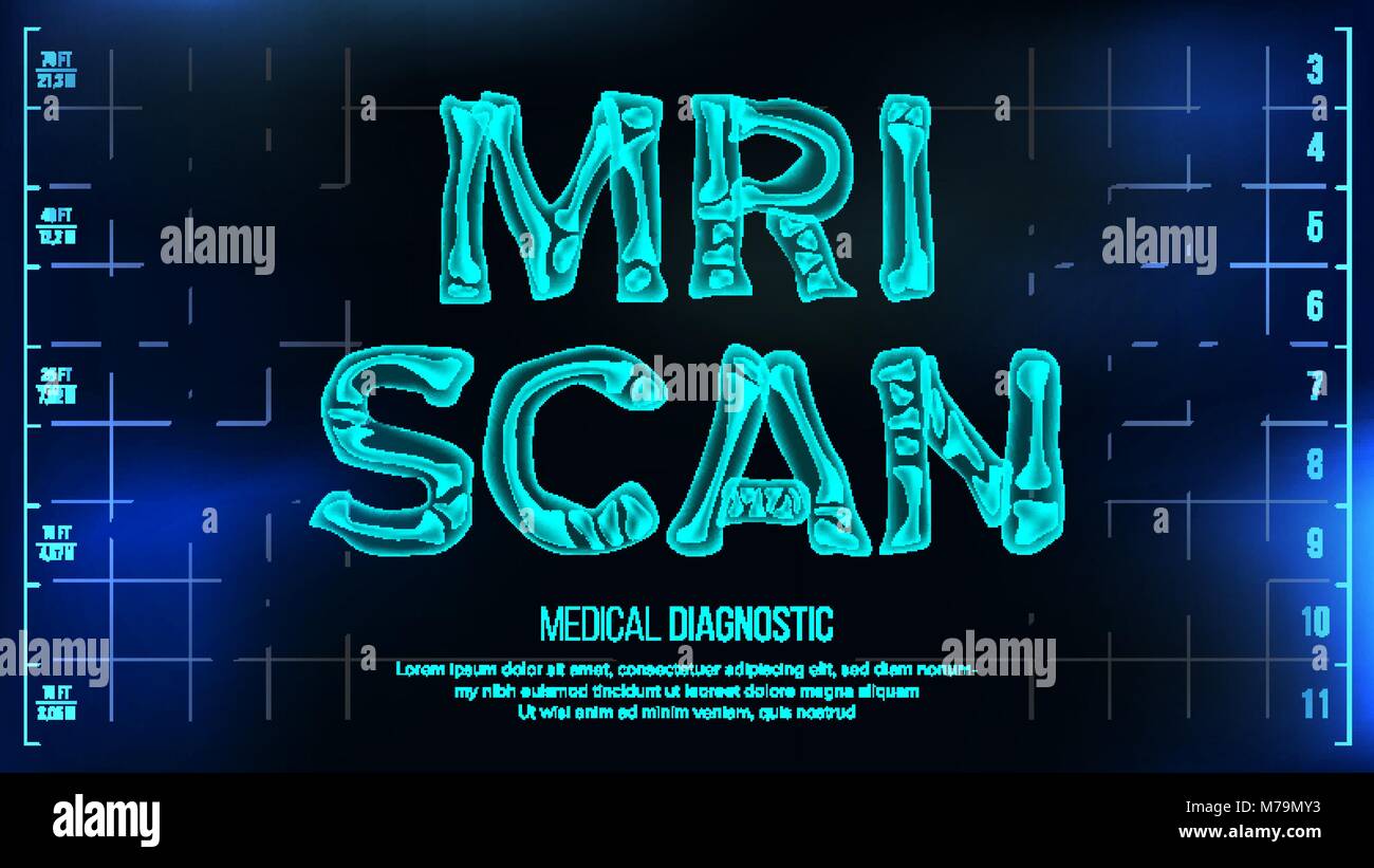 MRI Scan Banner Vector. Medical Background. Transparent Roentgen XRay