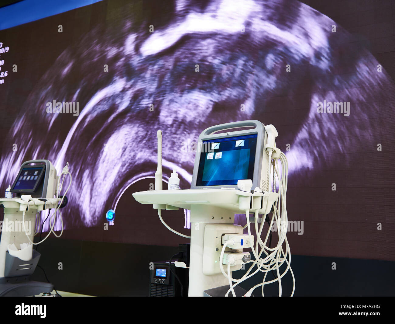 On screen ultrasound machine hi-res stock photography and images - Alamy