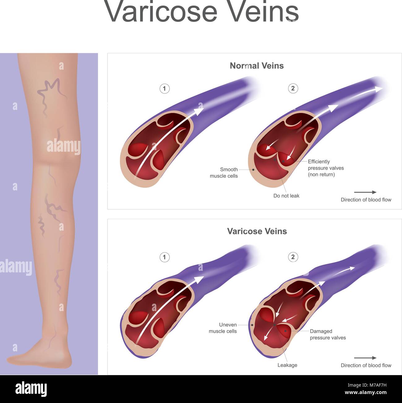 Was damaged or destroyed Stock Vector Images Alamy