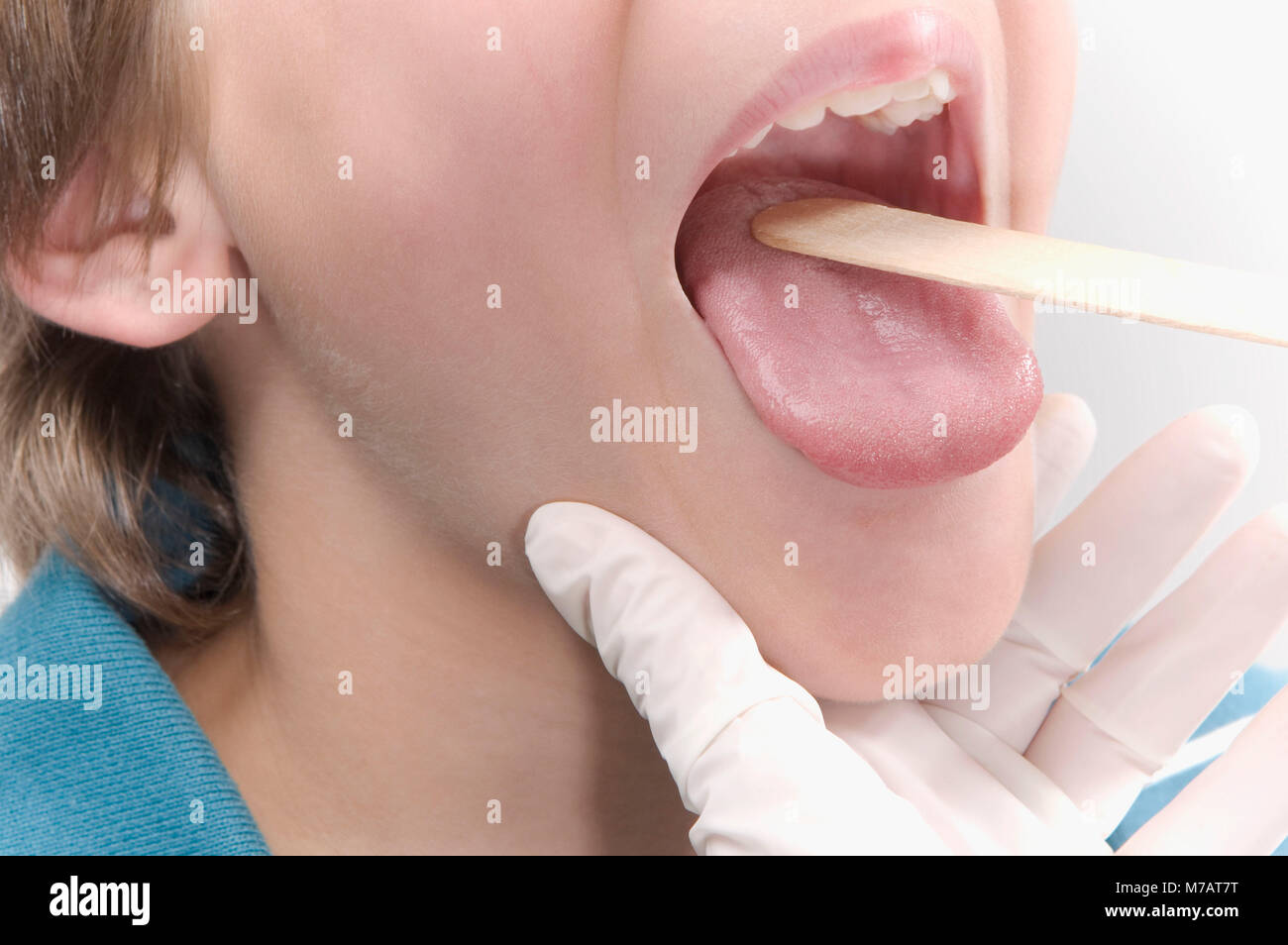Tongue Depressor Stock Photo - Download Image Now - Tongue