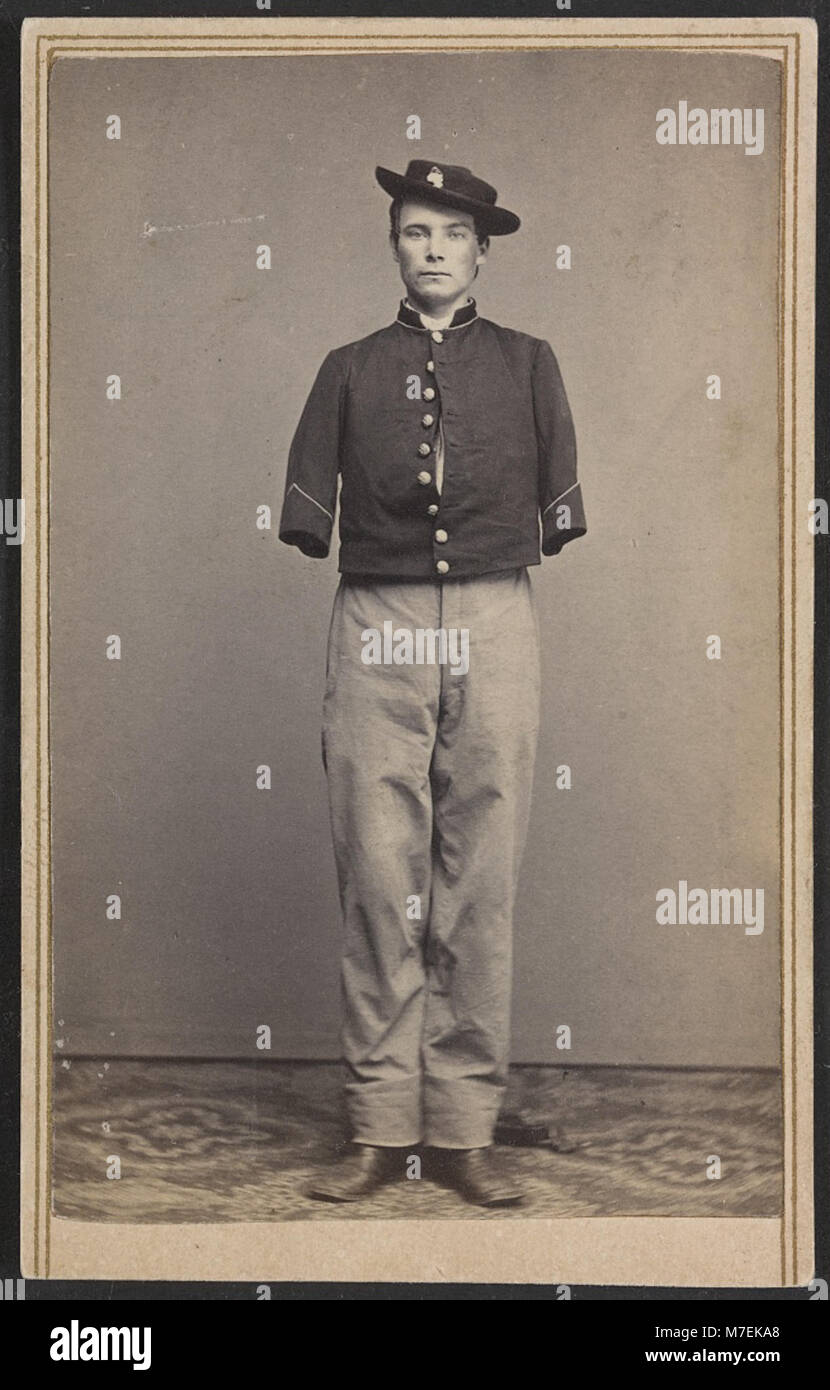 This photograph shows Private William Sergent of the 53rd Pennsylvania Infantry Regiment in uniform, after the amputation of both arms during the American Civil War. The image captures the resilience and sacrifice of soldiers during the war. Stock Photo