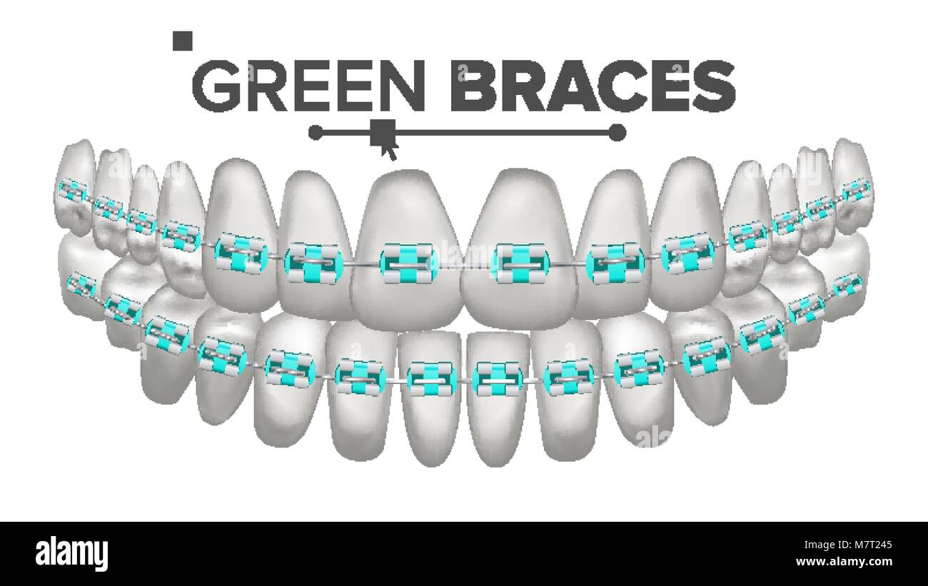 green colored braces