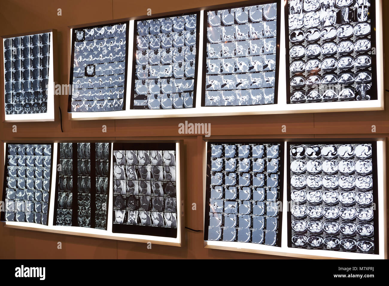 X-ray images of body parts on light wall Stock Photo