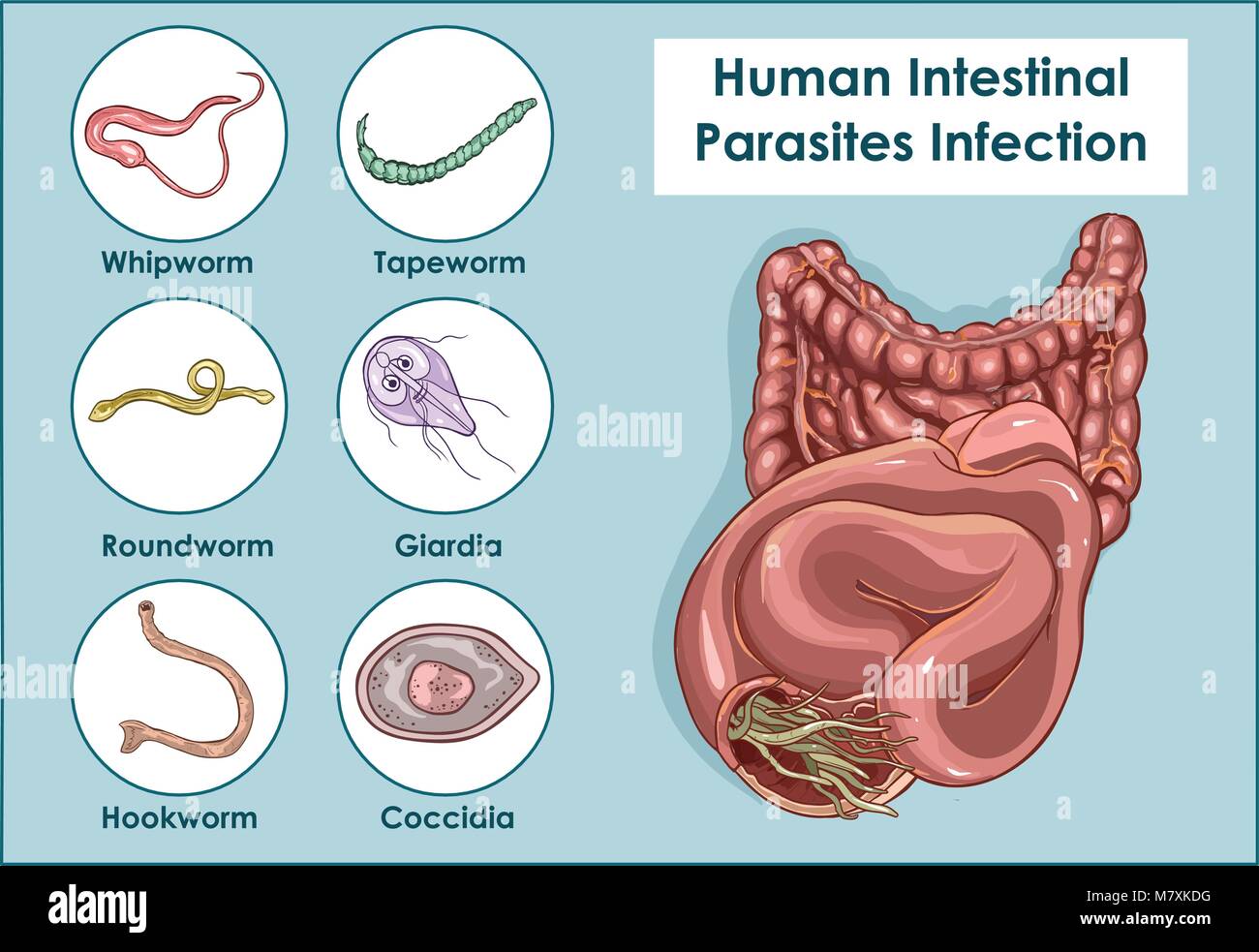 Vector Illustration of a Human Intestinal Parasites Stock Vector