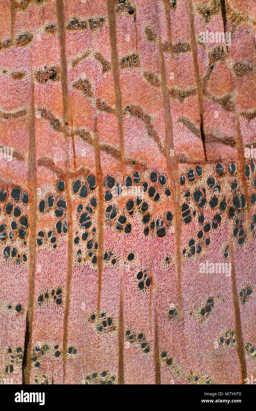 Laburnum cytisis, wood section LS. Darkfield photomicrograph Stock Photo