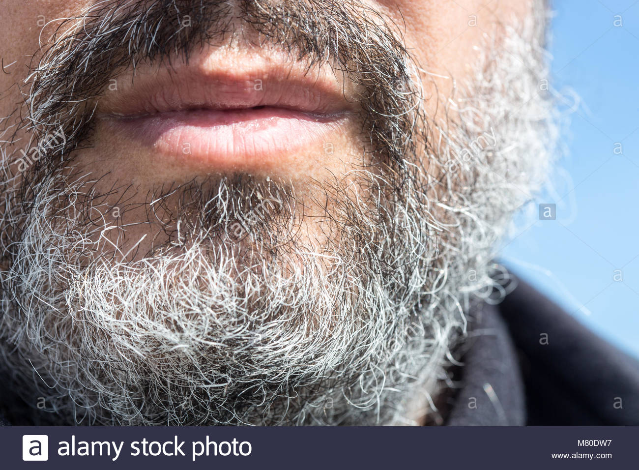 hairy mature closeup Anal fissure porn free