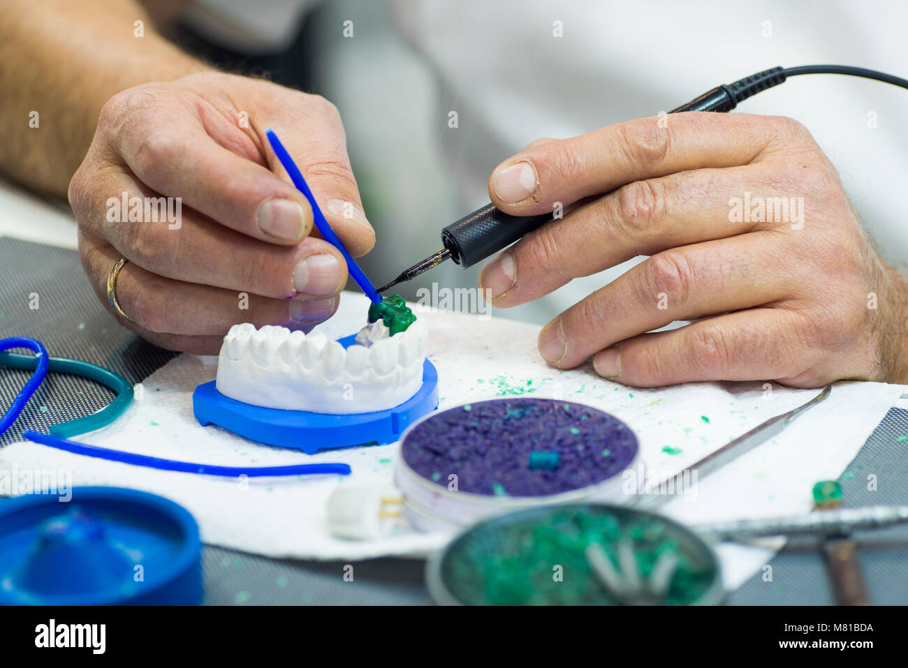 Doctor put tooth fillings on artificial jaw in dental clinic presenting