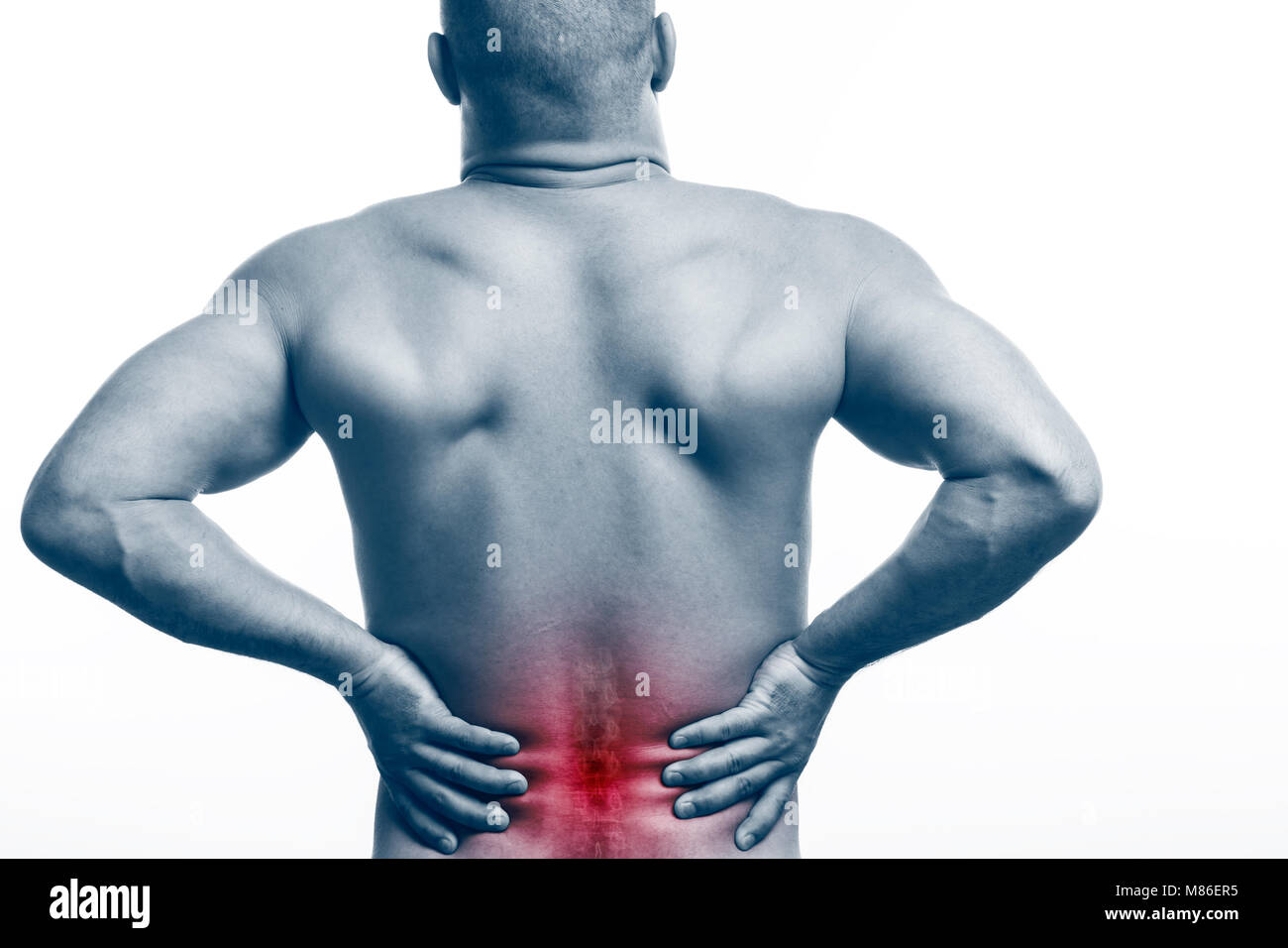 Injury of the spine. Young bald man sports physique holds a sick back ...