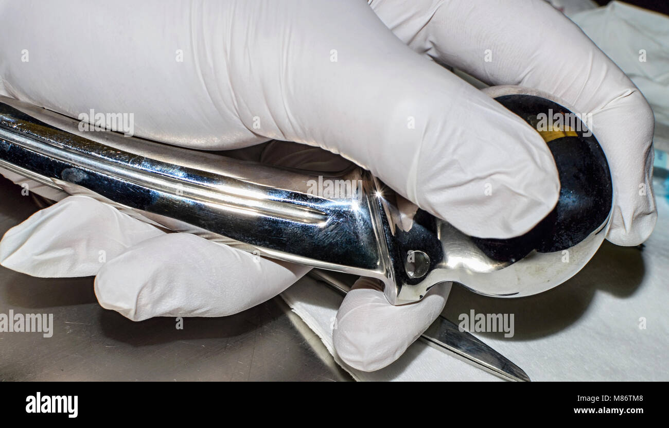 Artificial joint replacement before surgery. Stock Photo