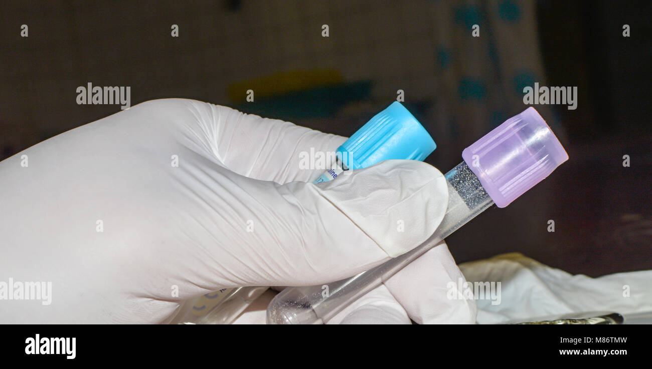 Blood sampling tubes Stock Photo Alamy