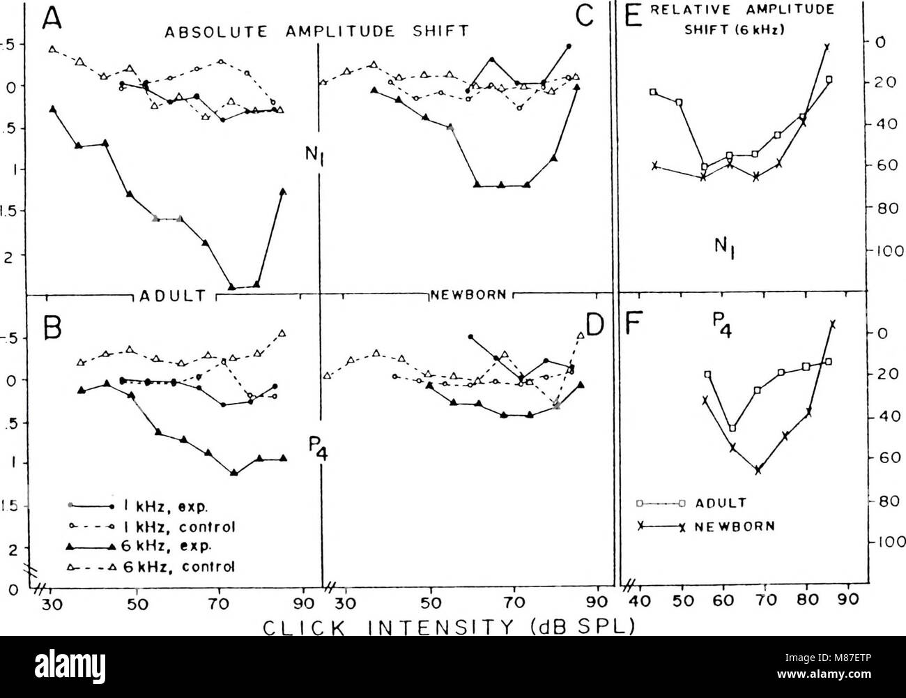 A 1980 study on the effects of intense acoustic noise on the cochlear ...