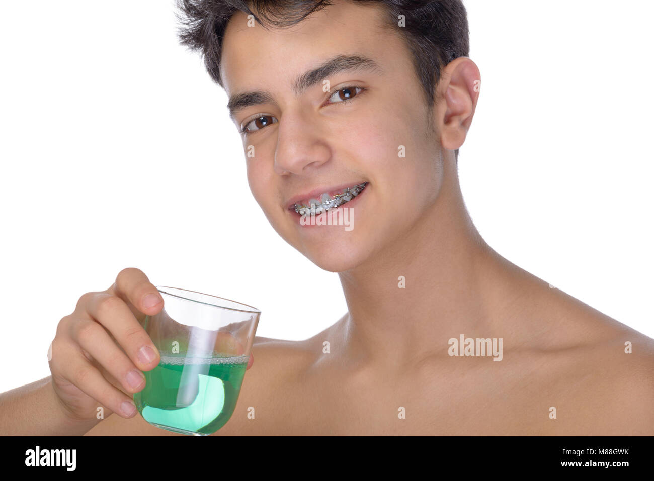 Cute teenager with white background, wearing braces on his teeth. Use