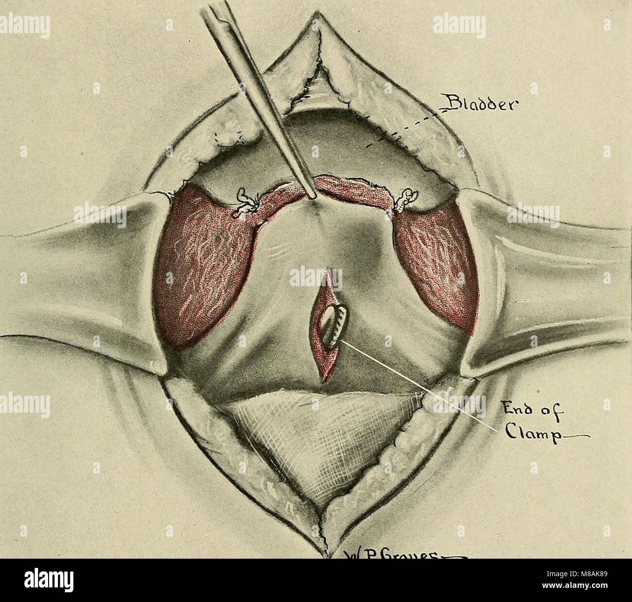 The 1916 publication 'Gynecology' is a medical text focusing on the ...
