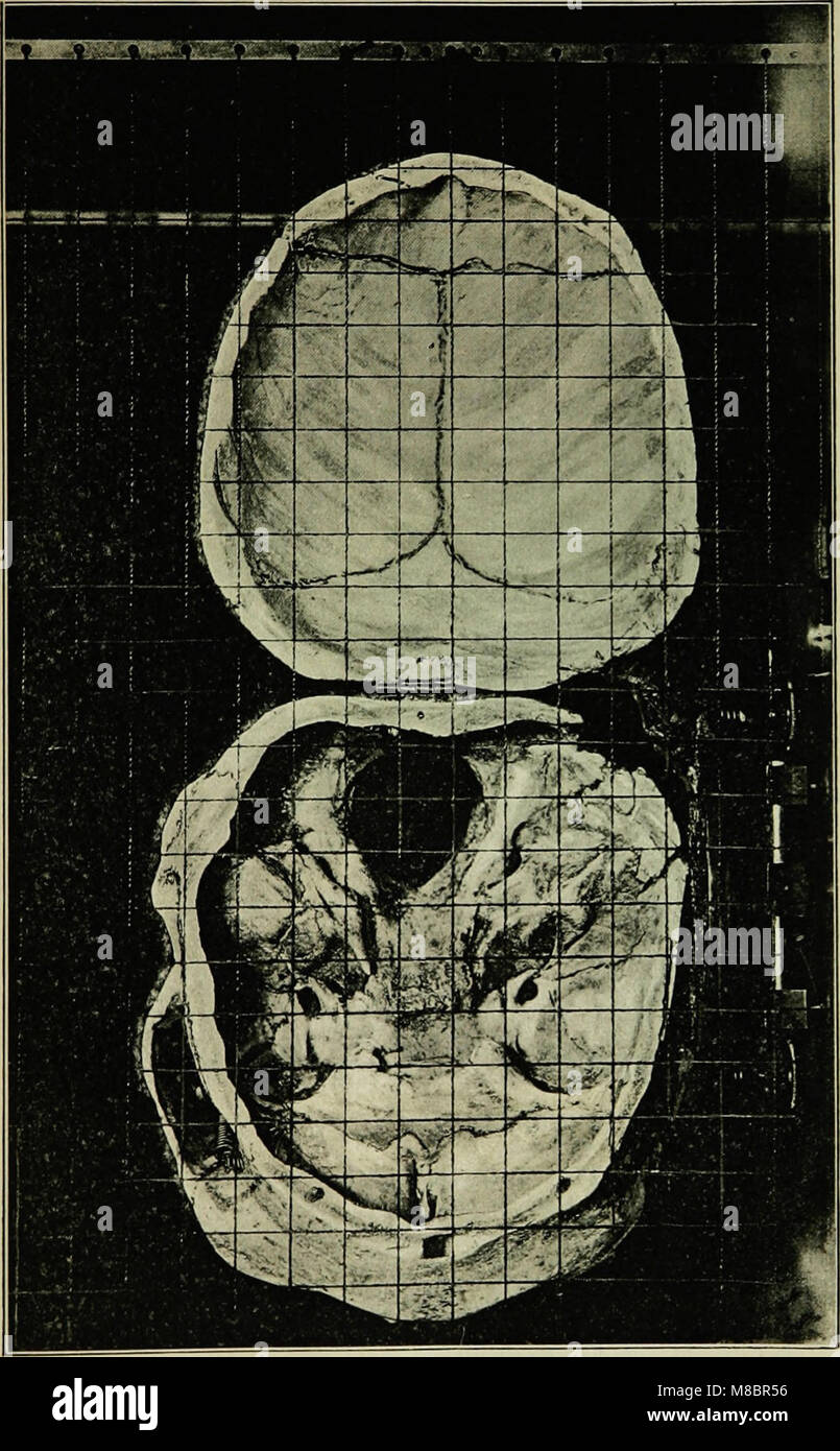 Diagnostik der Geisteskrankheiten für praktische Ärzte und Studierende (1901) (14597004368) Stock Photo