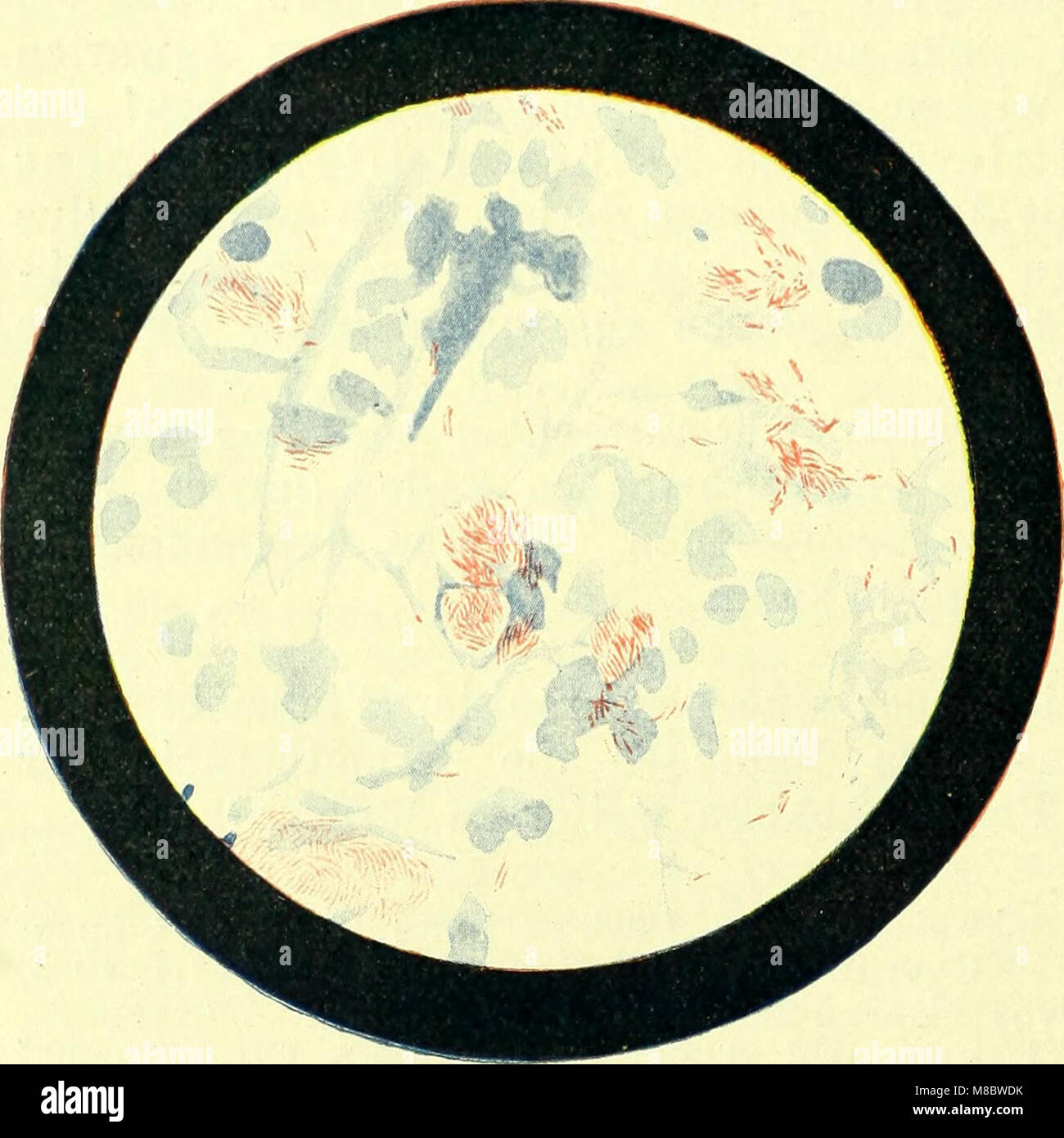 Die Bakteriologie in der Augenheilkunde (electronic resource) (1903) (20352721235) Stock Photo