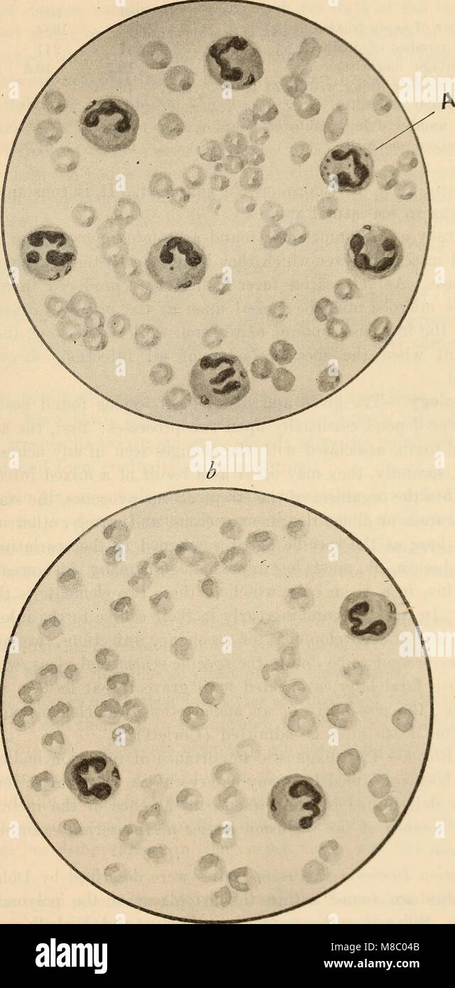 Diseases of infancy and childhood (1914) (14585405398) Stock Photo