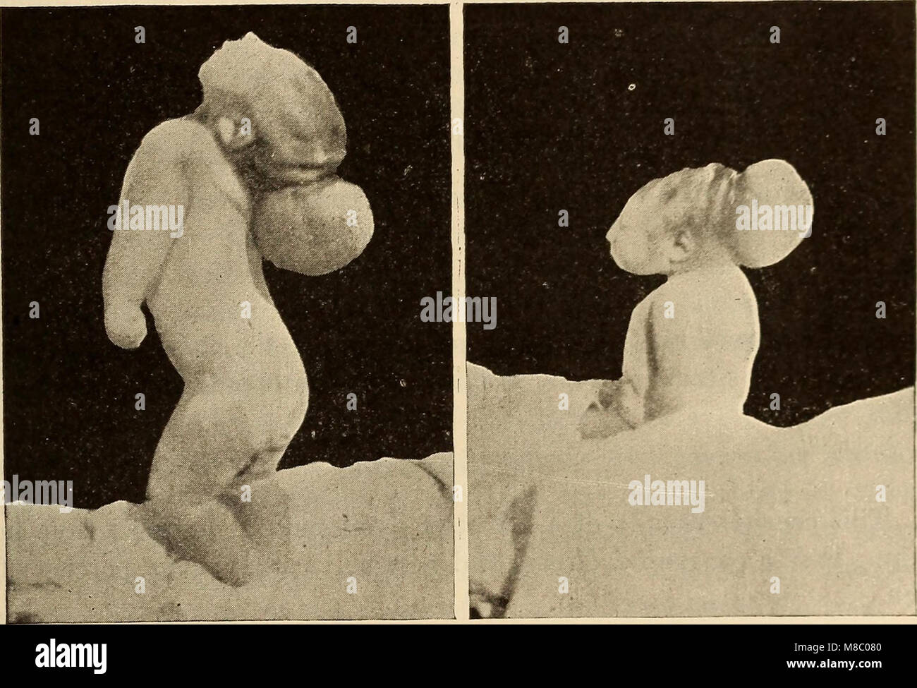 'Diseases of Infancy and Childhood' (1914) is a medical text that ...