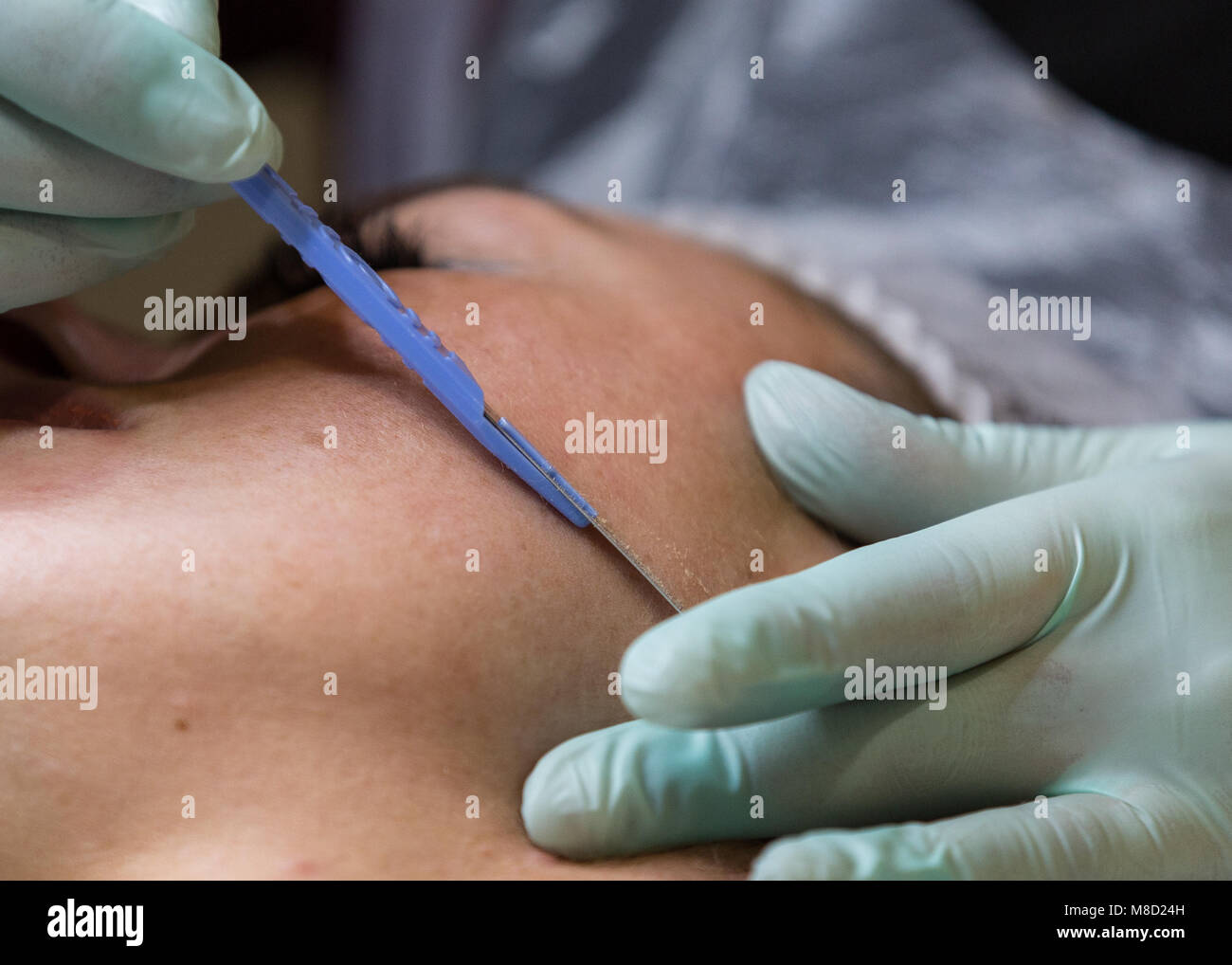 Dermaplaning exfoliation beauty therapy treatment - Dermaplane Facial Stock Photo