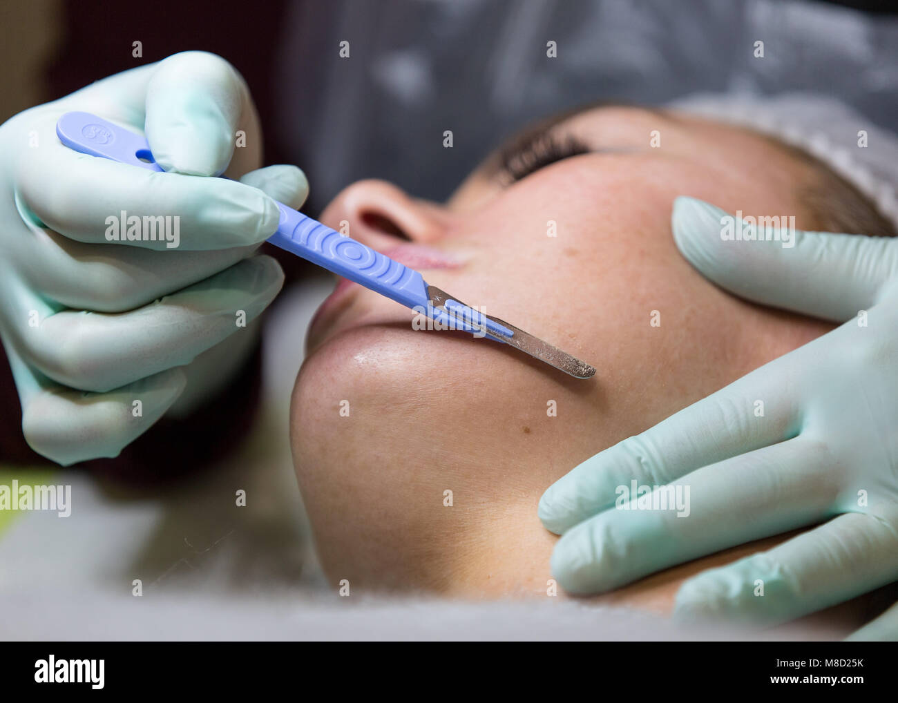 Dermaplaning exfoliation beauty therapy treatment - Dermaplane Facial Stock Photo