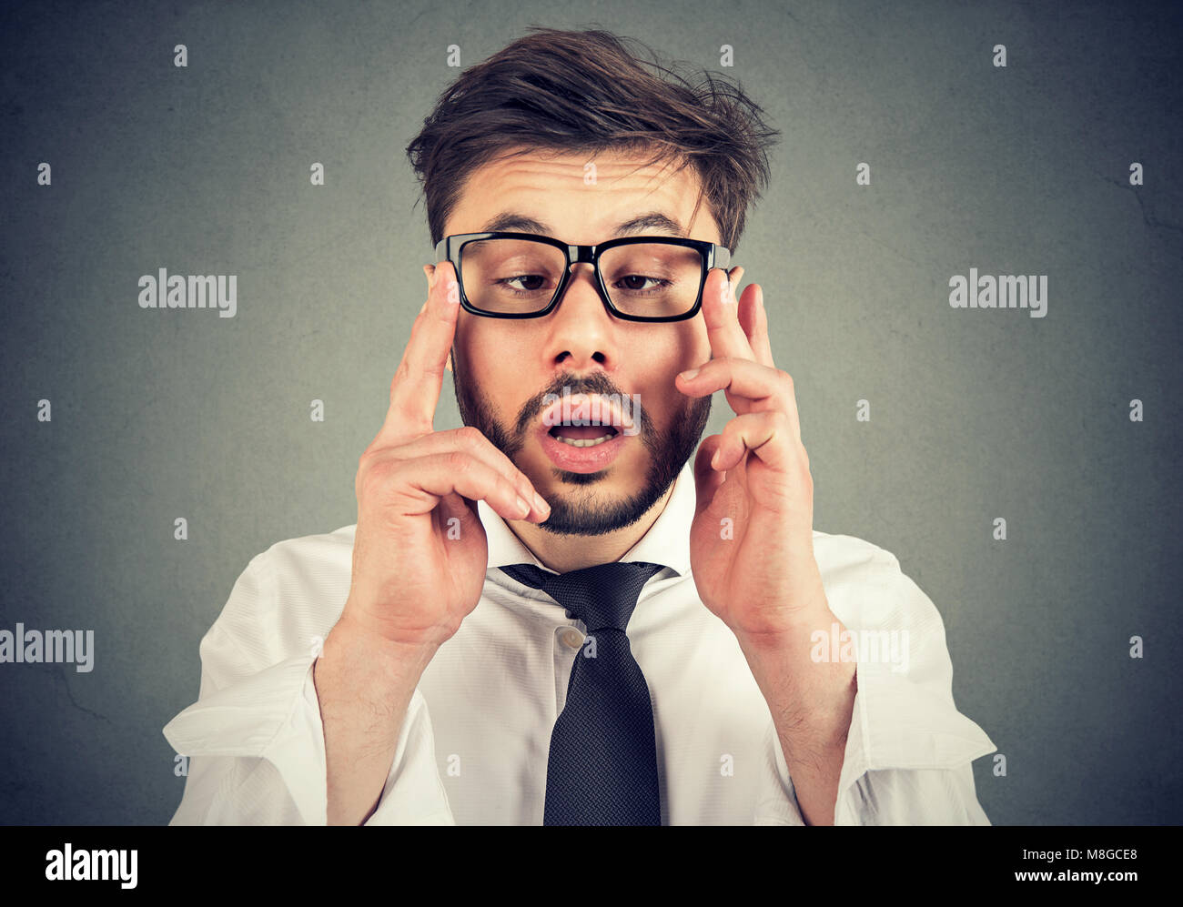Young man with strabismus vision problems Stock Photo