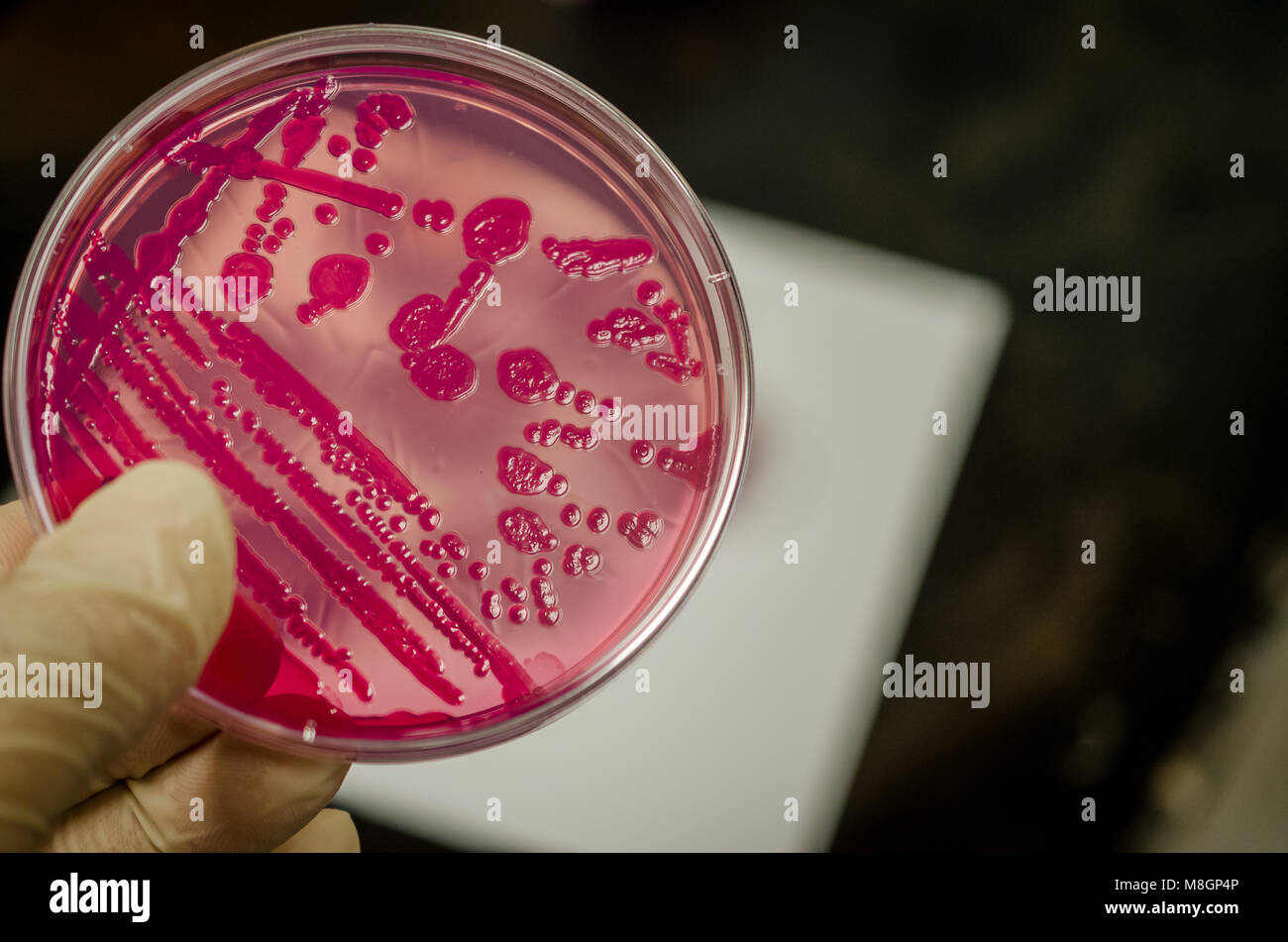 Bacterial culture plate holding in hand Stock Photo