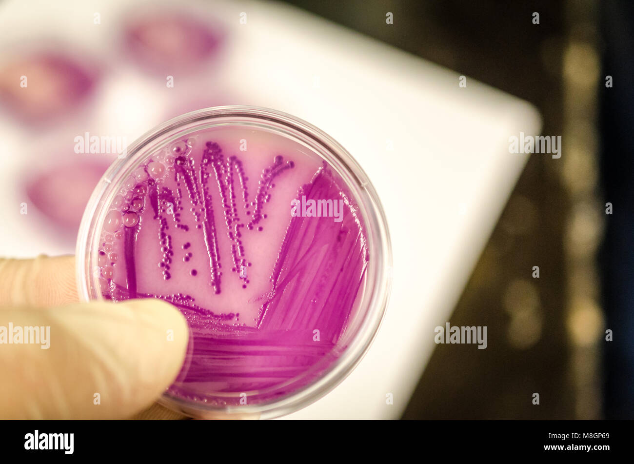 Bacterial culture plate holding in hand Stock Photo