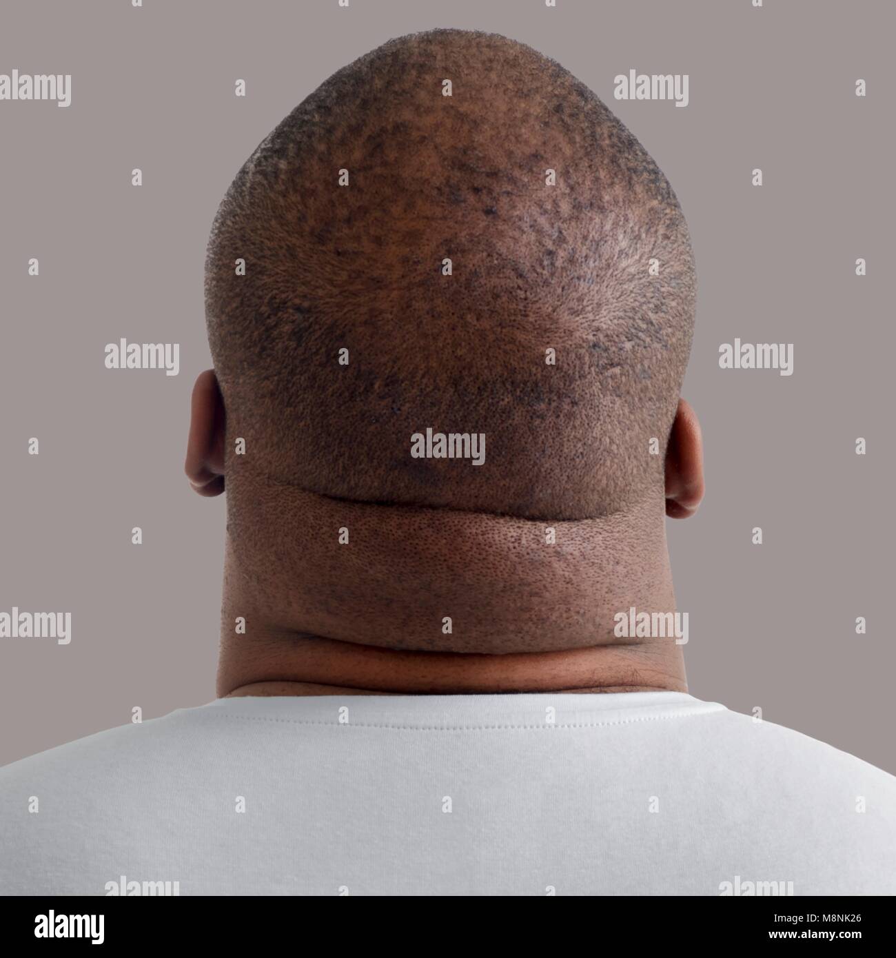 Close up of overweight man's neck, rear view Stock Photo Alamy