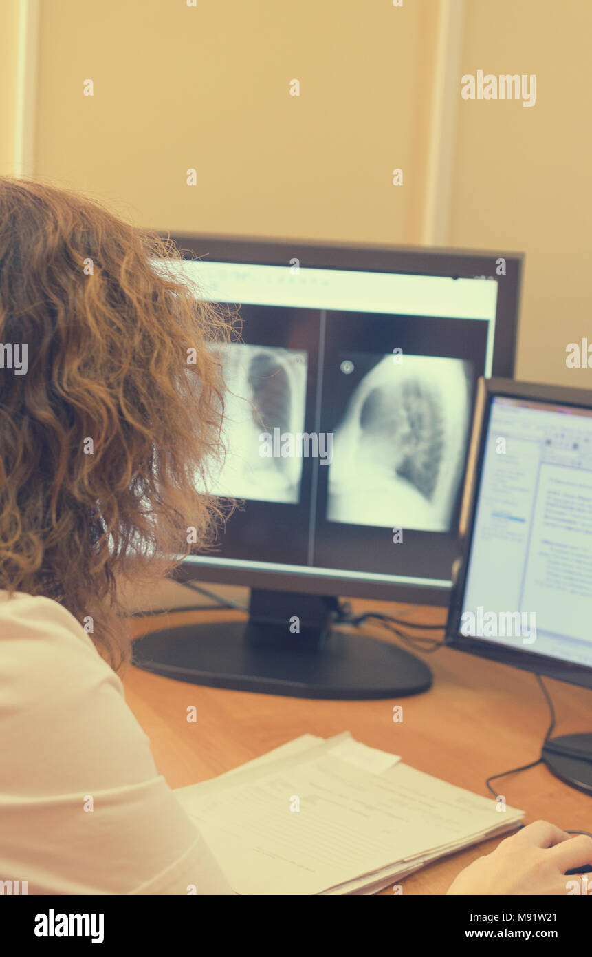 Real Radiologists Computer The radiologist looks at the x-ray images on a computer monitor Stock ...
