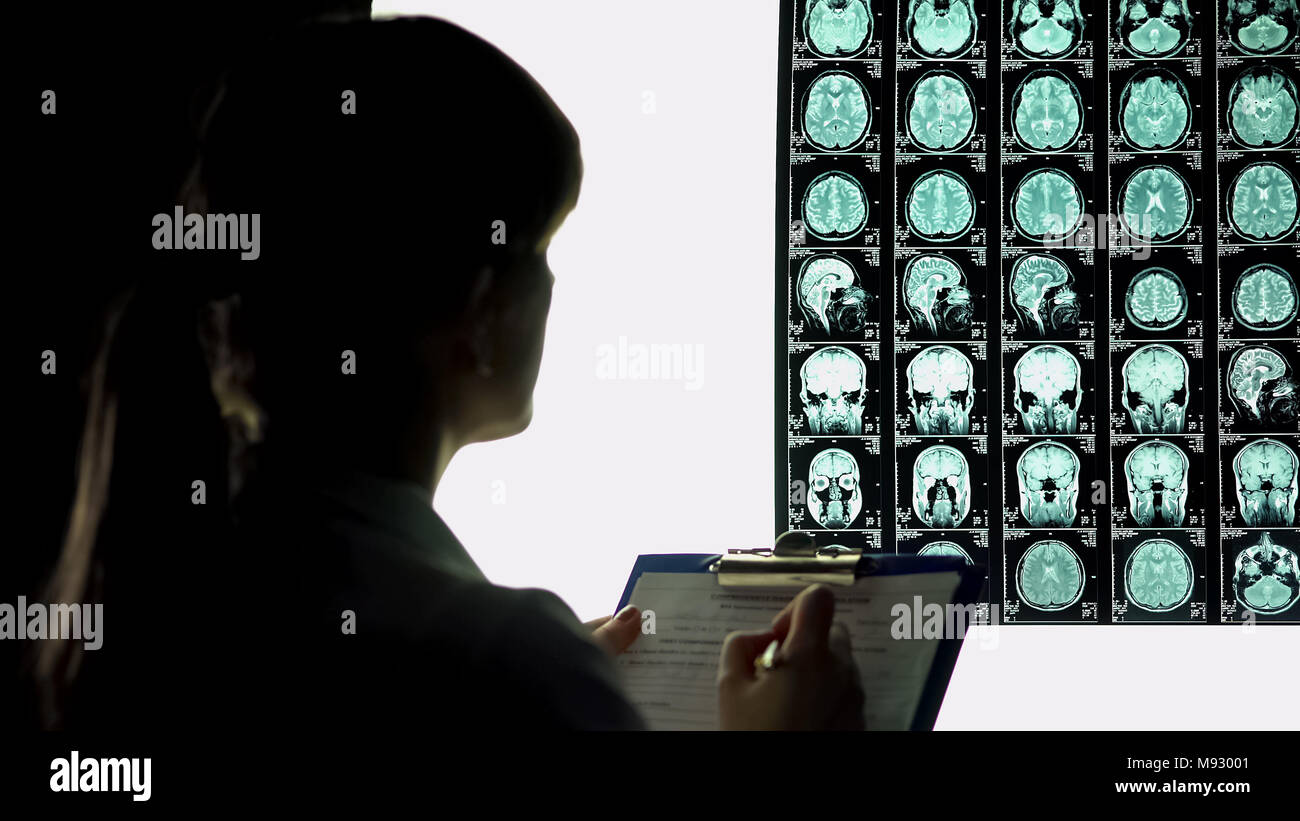 Female neurologist looking thoughtful at brain x-ray, writing down diagnosis Stock Photo
