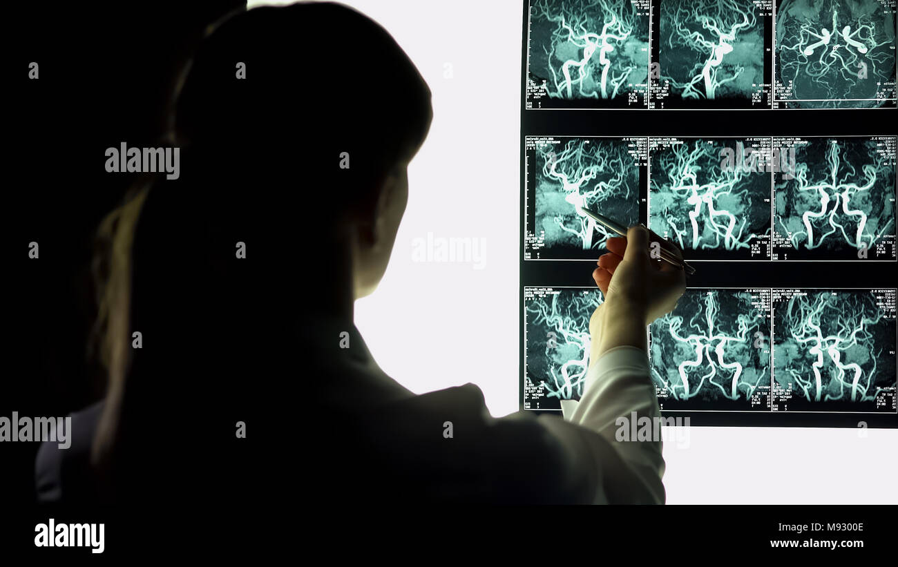 Neurosurgeon examining blood vessels x-ray, making diagnosis, patient treatment Stock Photo