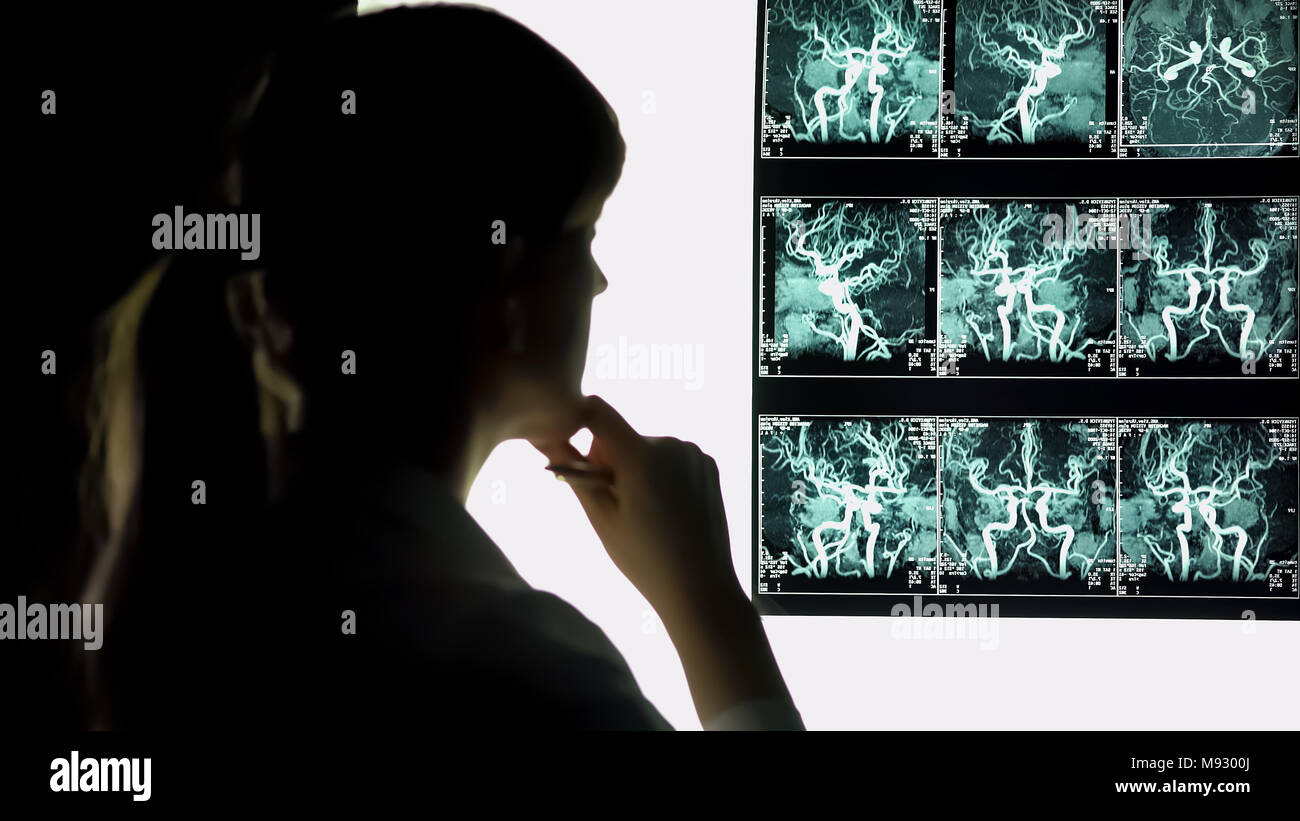 Thoughtful doctor looking at blood vessels x-ray, health care, neurosurgeon Stock Photo