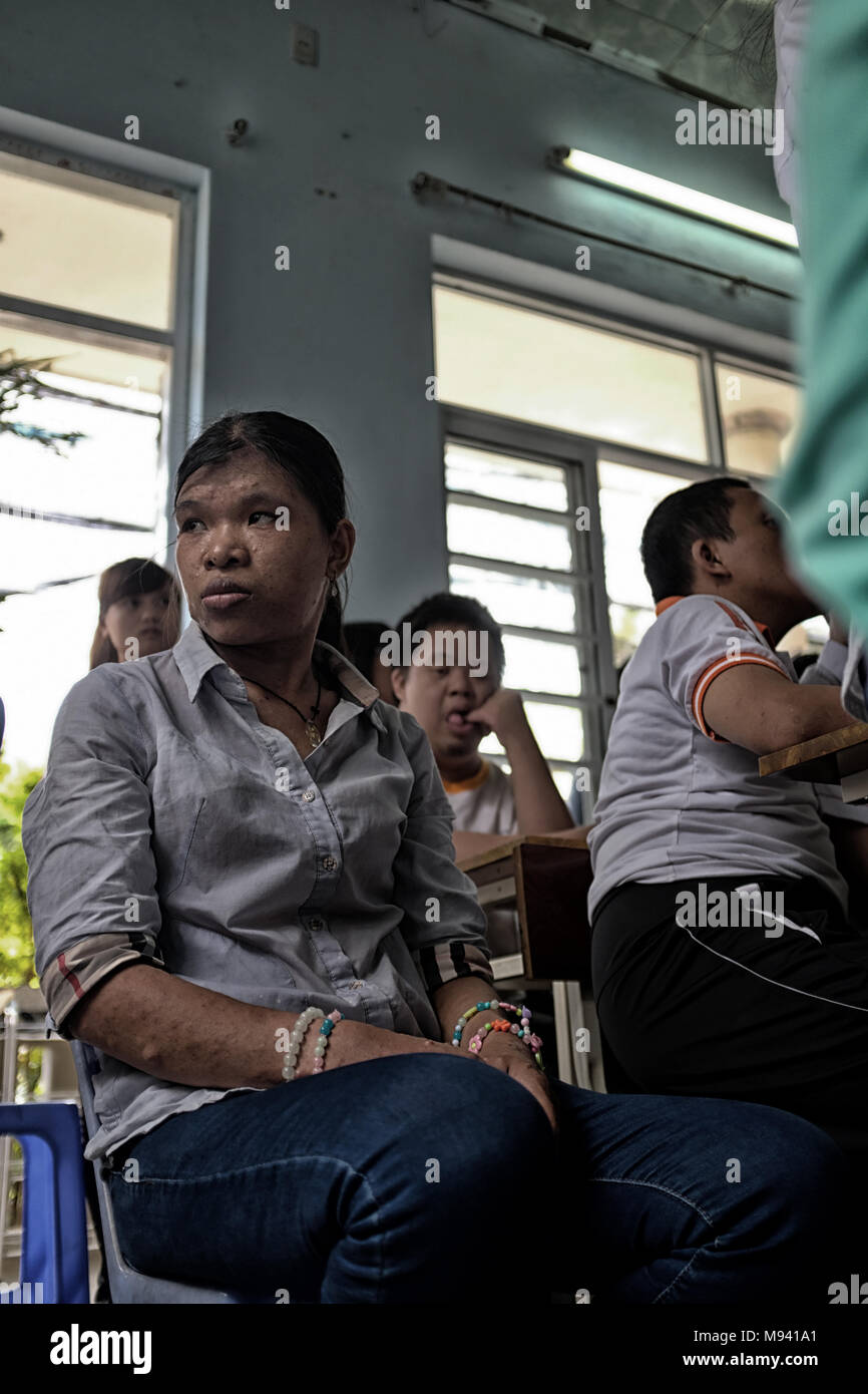 Agent Orange Victims in Vietnam Stock Photo