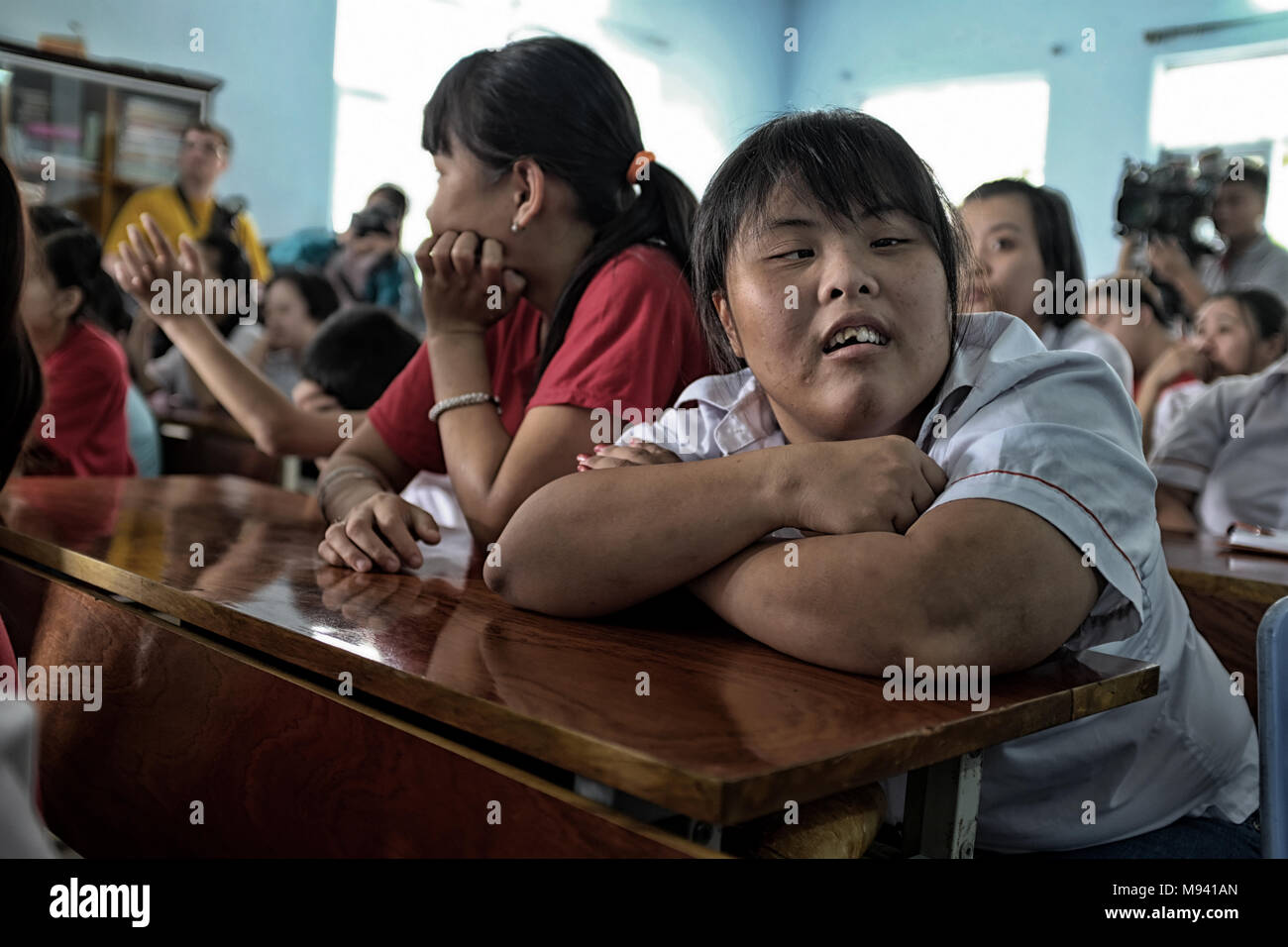 Agent Orange Victims In Vietnam Stock Photo Alamy