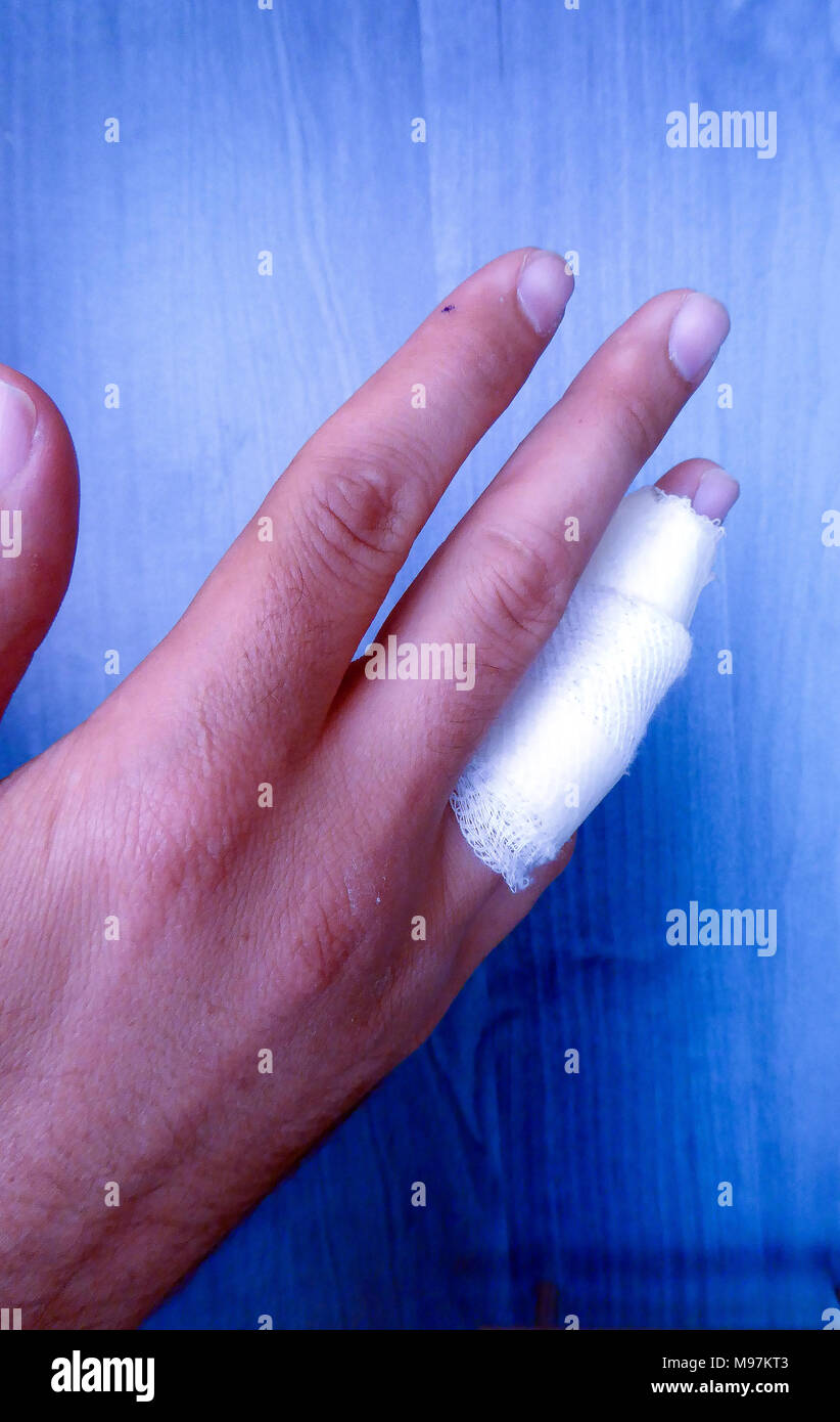 Gauze finger hires stock photography and images Alamy