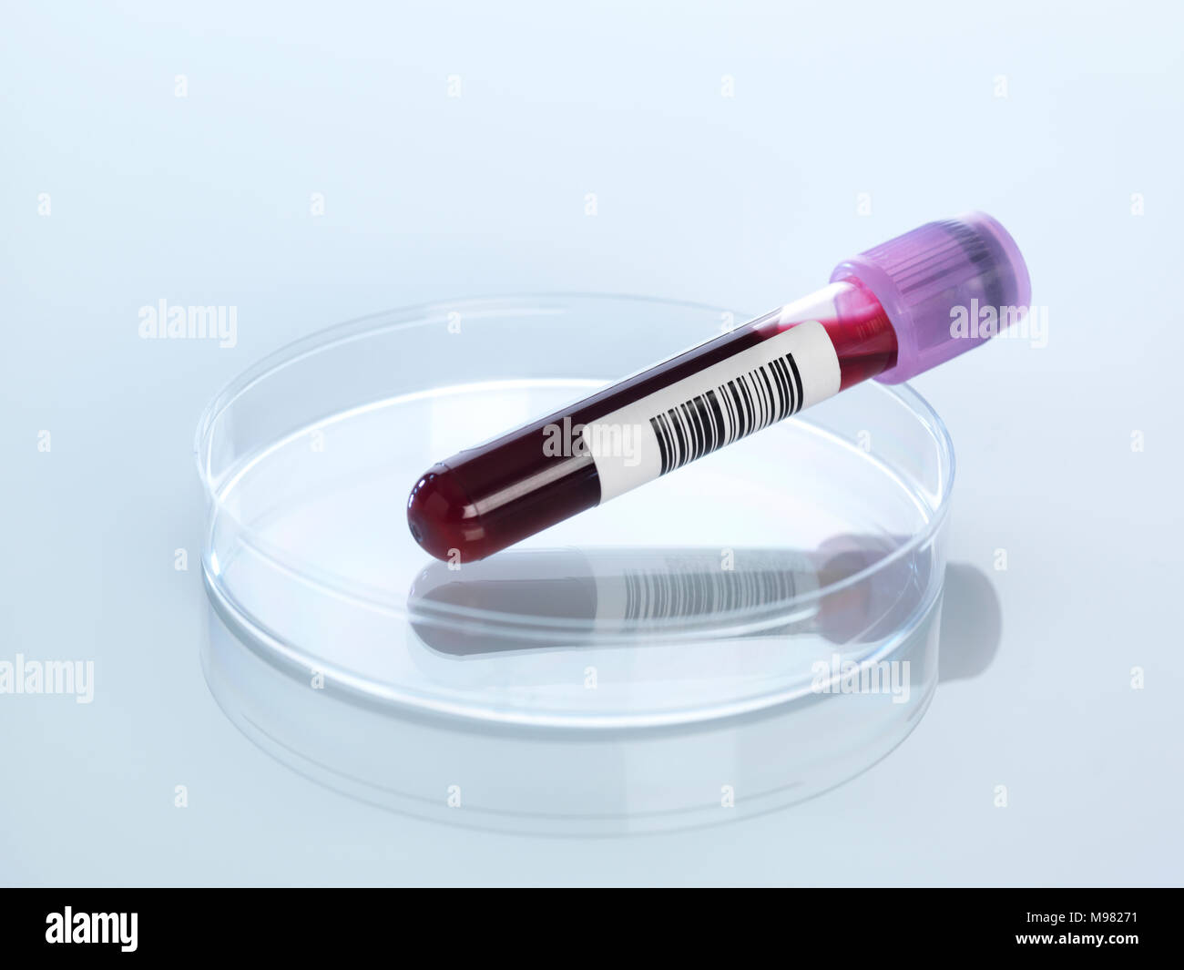 Blood sample in petri dish Stock Photo