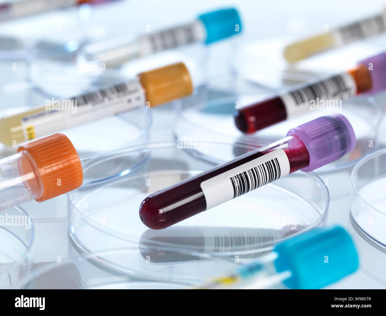 Human blood and other medical samples in petri dishes Stock Photo