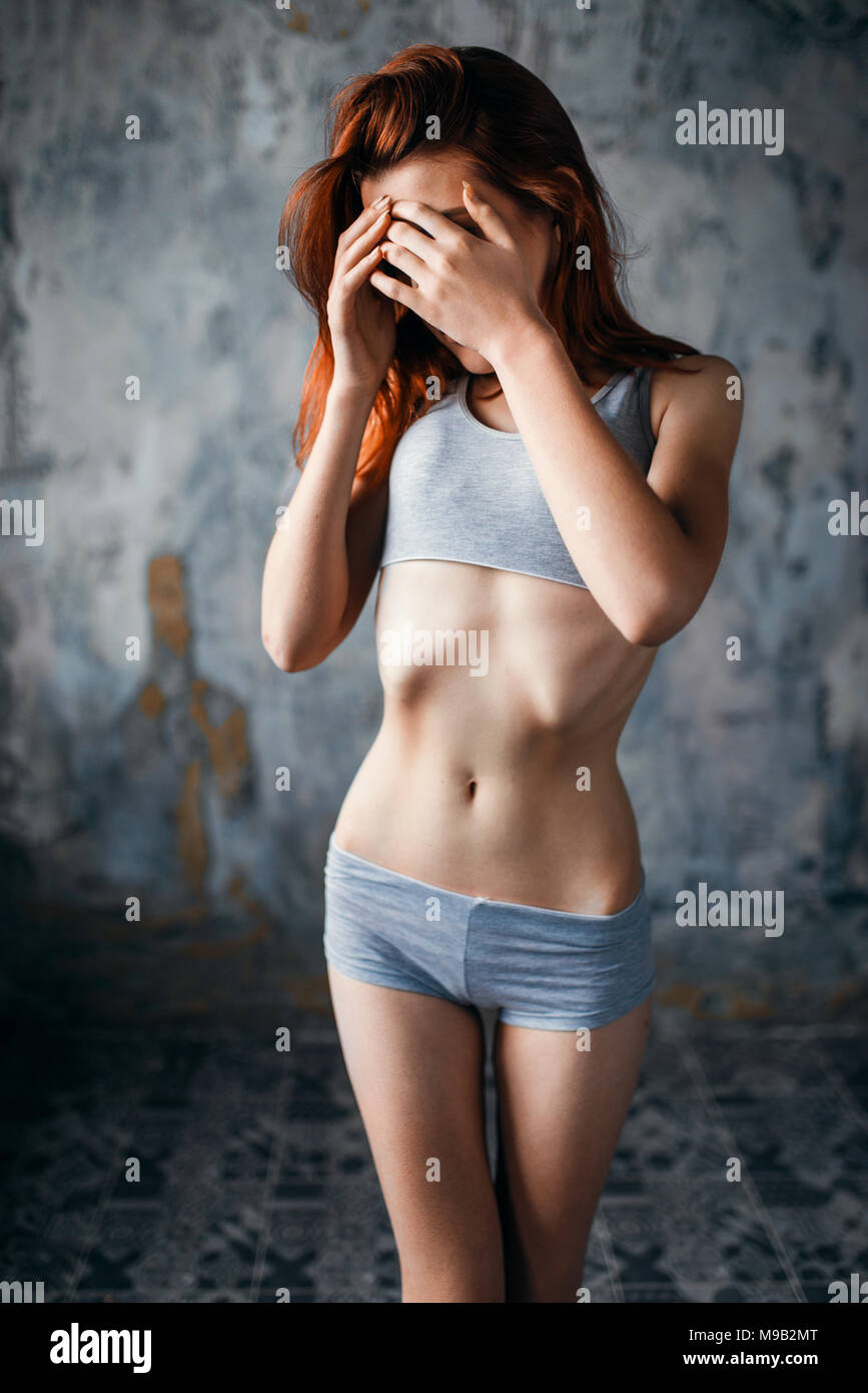 Anorexic woman, weight loss, anorexia Stock Photo