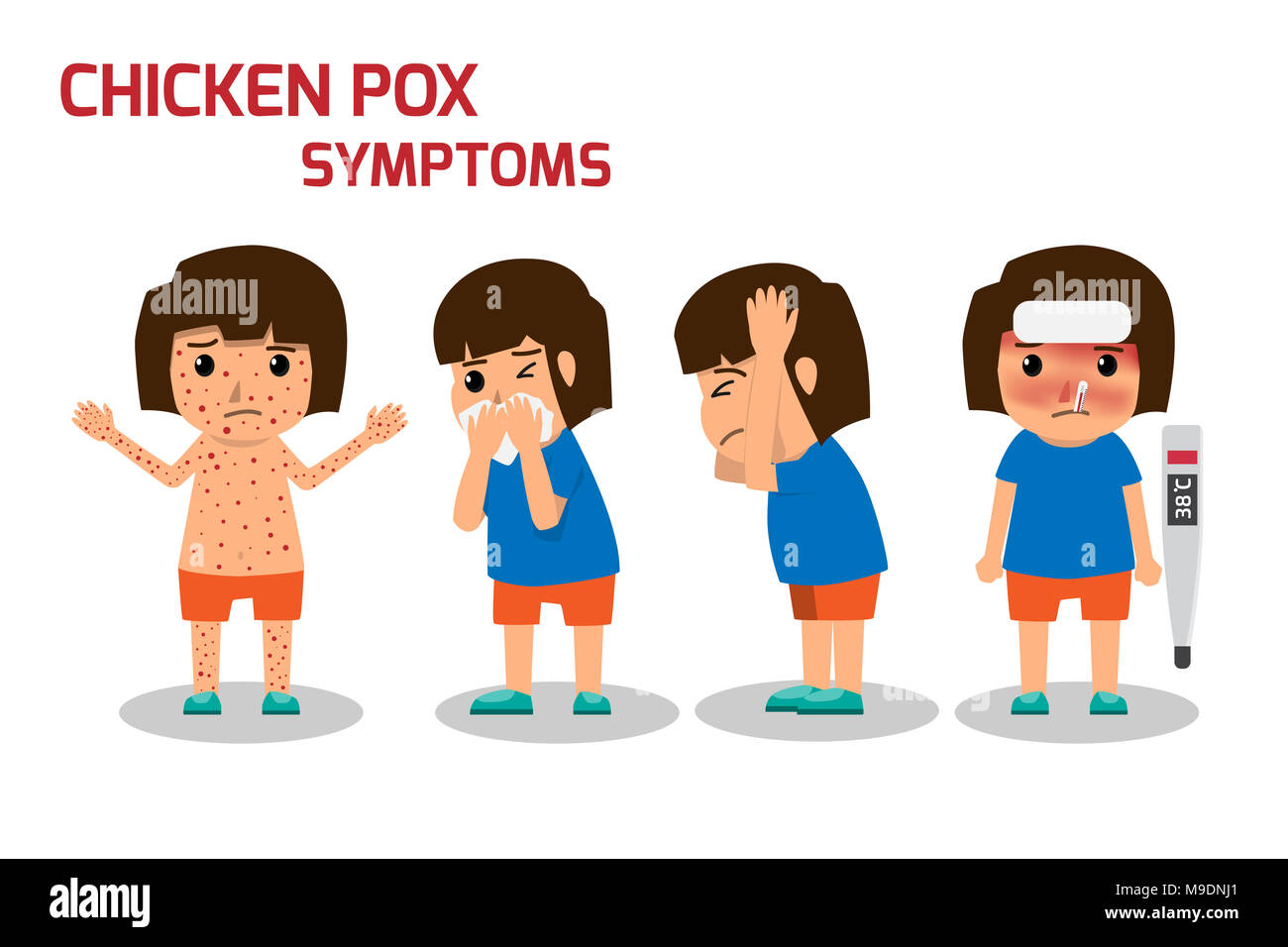 Chicken pox symptoms