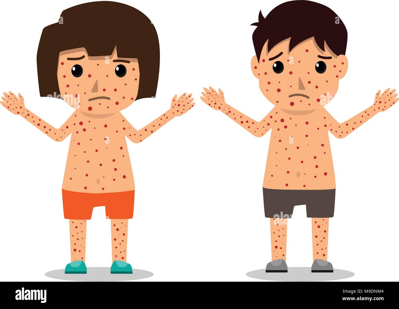 Children has chicken pox infographic, Poster children fever and chickenpox  symptoms and prevention. Health care cartoon character vector illustration  Stock Vector Image & Art - Alamy