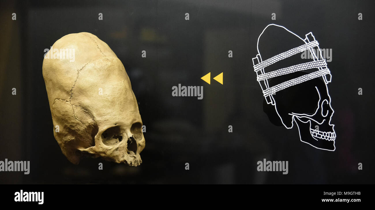 Deformed Ancient Peruvian Skull Stock Photo