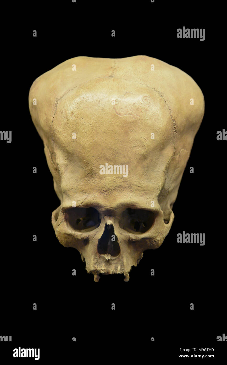 Deformed Ancient Peruvian Skull Stock Photo