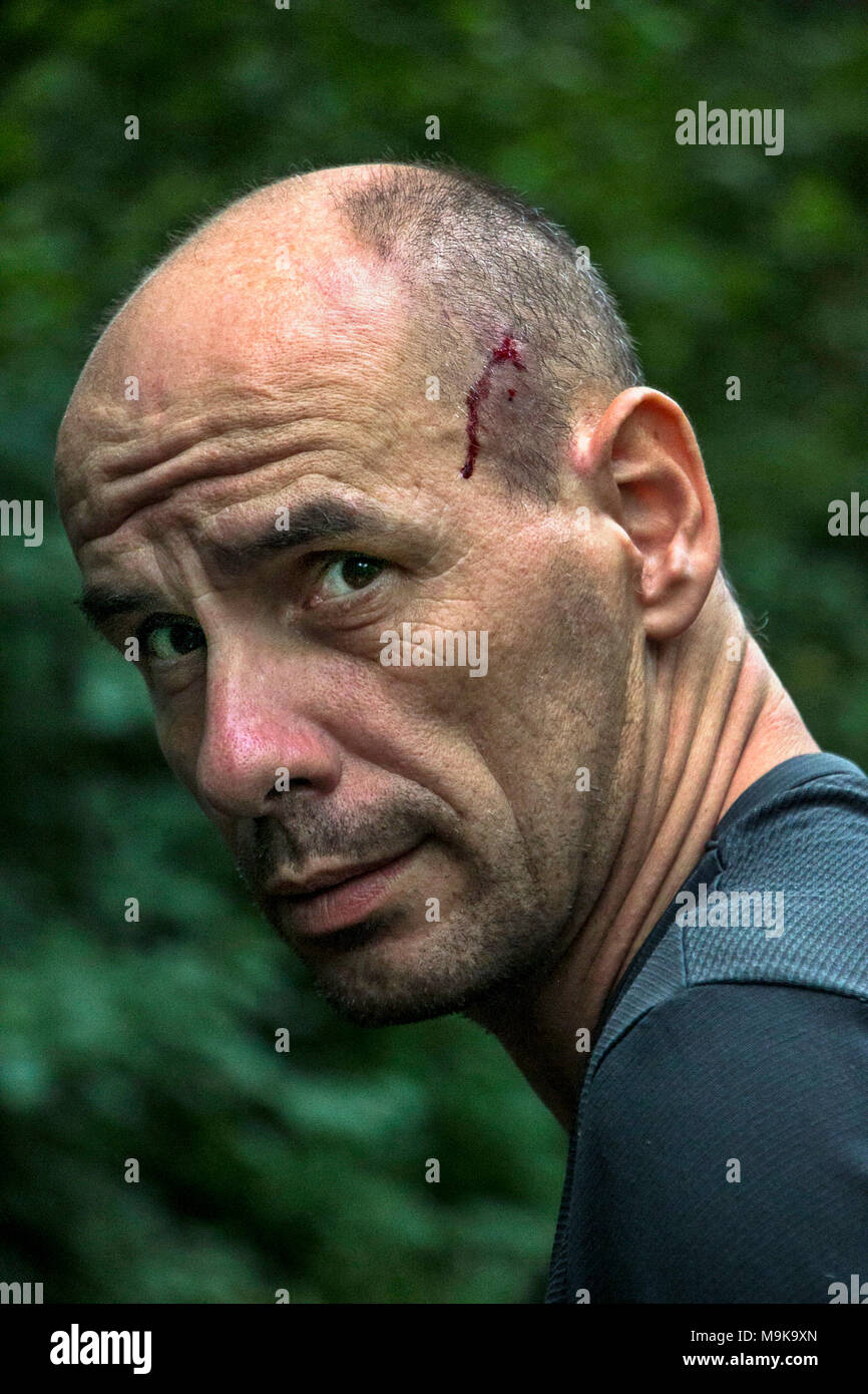 Portrait of man with small bleeding wound on his head, thoughtful and worried being lost. Concept of exploration and survival in the wilderness. Stock Photo