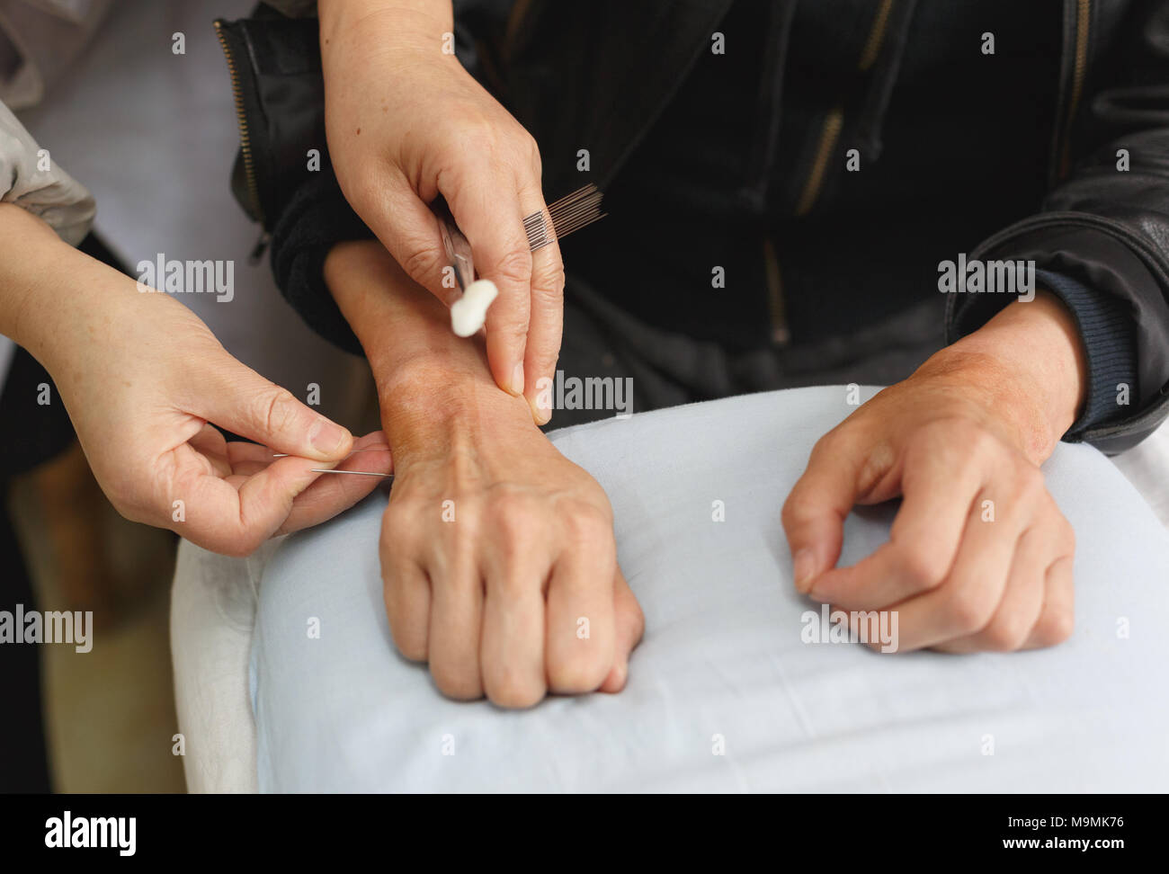 Acupuncture scene at a clinic in China Stock Photo Alamy