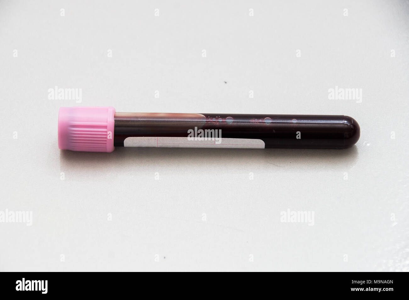 Blood sample laying on the ground hires stock photography and images Alamy