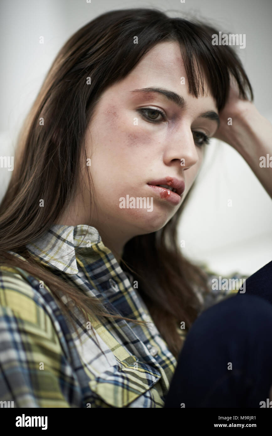 Female Victim Of Domestic Abuse At Home Stock Photo Alamy