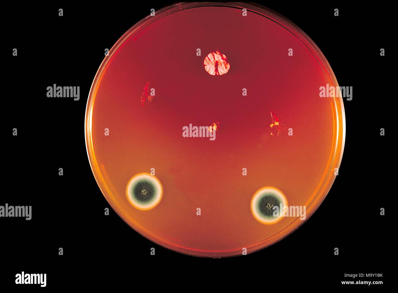 Tinea skin condition ringworm hires stock photography and images Alamy