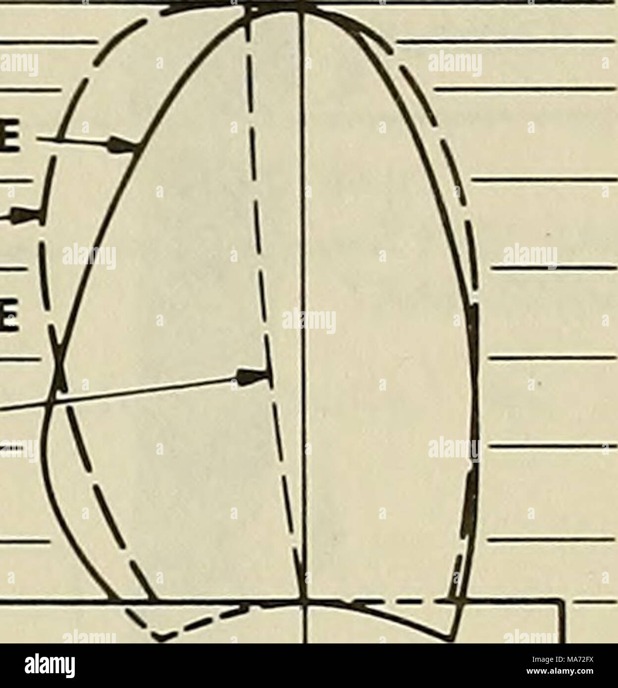 . The effects of hull pitching motions and waves on periodic propeller