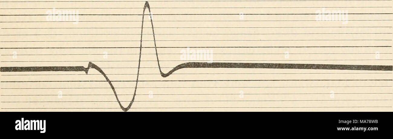. Elektrophysiologie menschlicher Muskeln . Abb. 22. Dasselbe. Koter Muse. Soleus der Katze. Elektrodendistanz 20 mm. Erheblich längere Dauer und größerer Gipfelabstand der Stromperiode, als in Abb. 21. (Nach Kohl rausch.) abstand aufgenommen sind, so ist auch hier das Verhältnis etwa 4:3. Der Wellenlängenunterschied ist aber noch beträcht- lich größer. Das Verhältnis ist hier etwa 3:2. Die relative Trägheit der roten Muskeln kommt also in diesen Messungen ganz eklatant zum Vorschein. Stock Photo